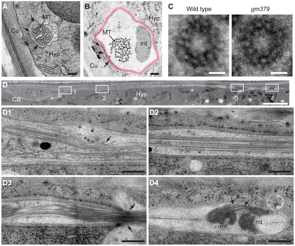 Ultrastructural characterization of neuronal defects of the <i>gm379</i> mutant.