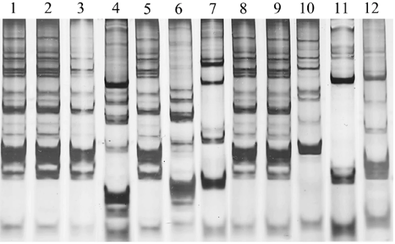 DNA fingerprint profiles of <i>L. paracasei</i> SD1 contained in milk powder (lane 1) and 11 clinical lactobacilli strains (lanes 2–12) isolated from saliva of four individual children who received milk contained <i>L. paracasei</i> SD1 at T9 of study: lanes 2–4, lanes 5–7, lanes 8–10, and lanes 11–12 isolates from child 1, 2, 3 and 4, respectively. The child 1, 2 and 3 had the isolates in lanes 2, 3, 5, 8 and 9, which showing the DNA fingerprint profiles similar to <i>L. paracasei</i> SD1. <i>L. paracasei</i> SD1 could not be detected in the child 4.