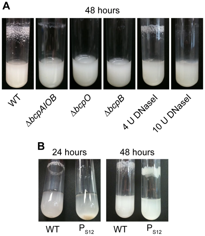 <i>bcpAIOB</i>-dependent autoaggregation in M63 minimal medium.