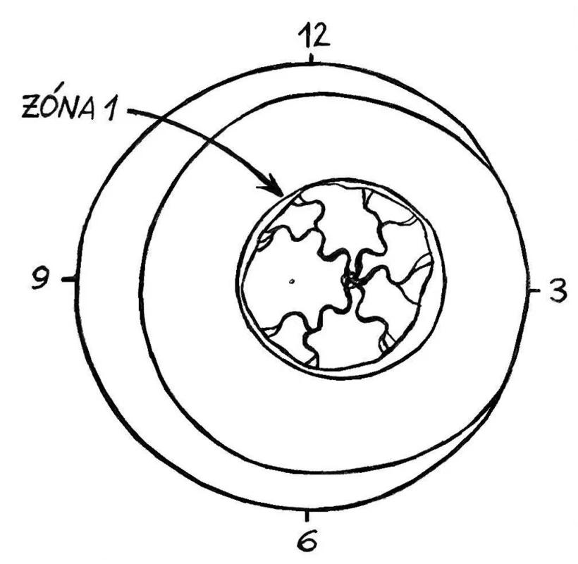 Agressive Posterior ROP (AP-ROP)