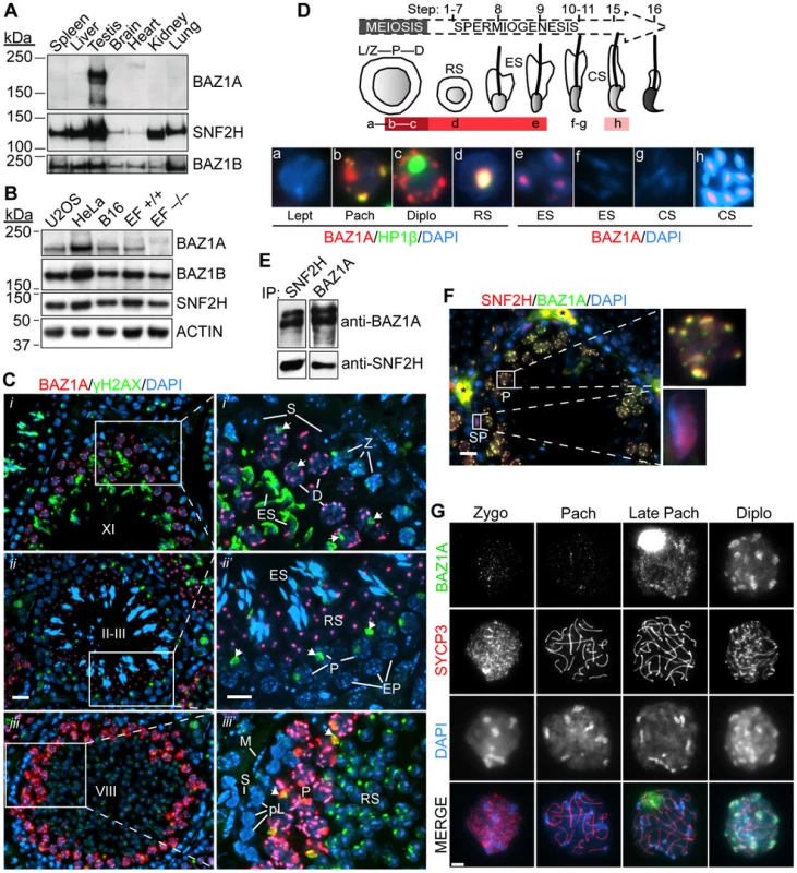 Expression and localization of BAZ1A in male germ cells.
