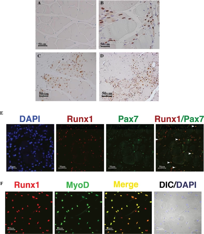 Runx1 expression in response to muscle damage.