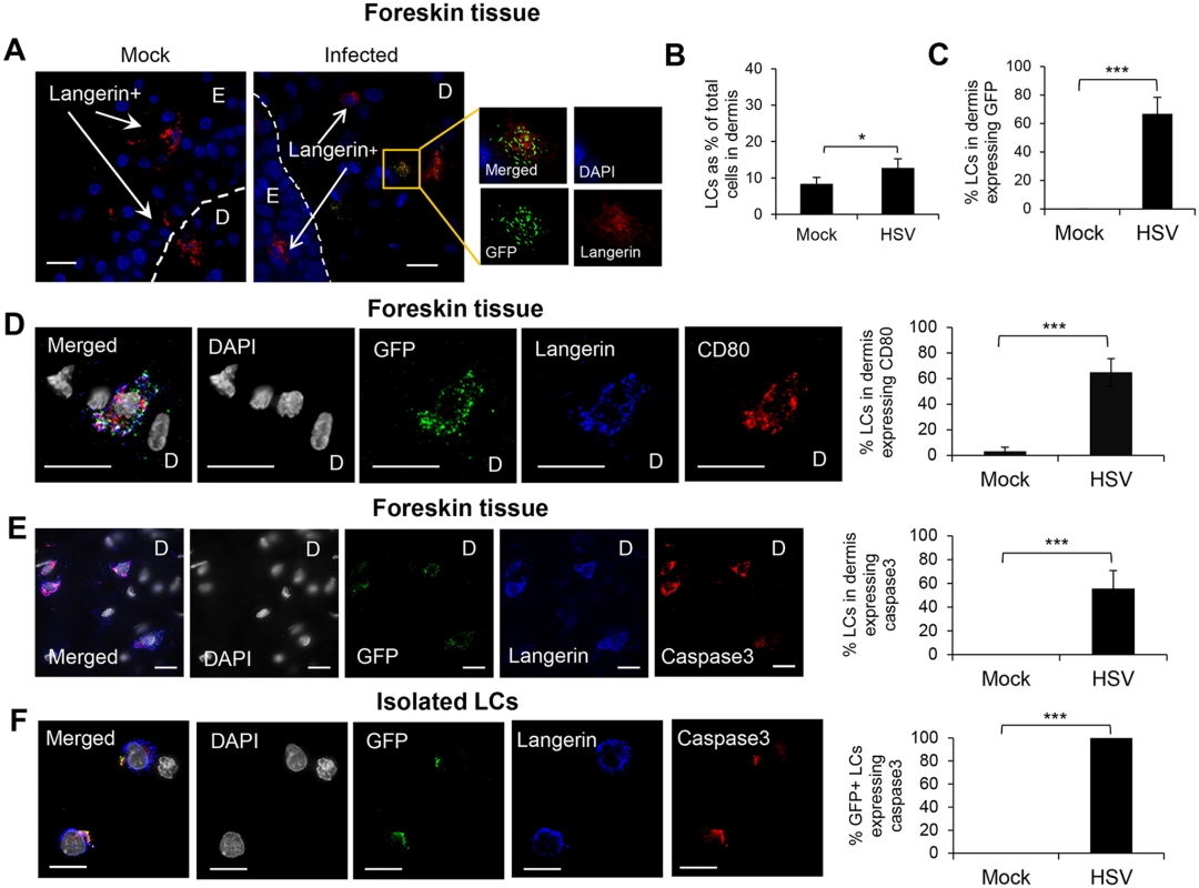 Fate of human LCs infected with HSV-1.