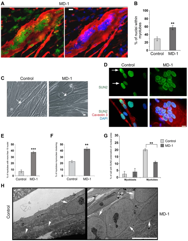 Enhanced rate of differentiation, nuclear misalignment and clustering in MD-1 myotubes.
