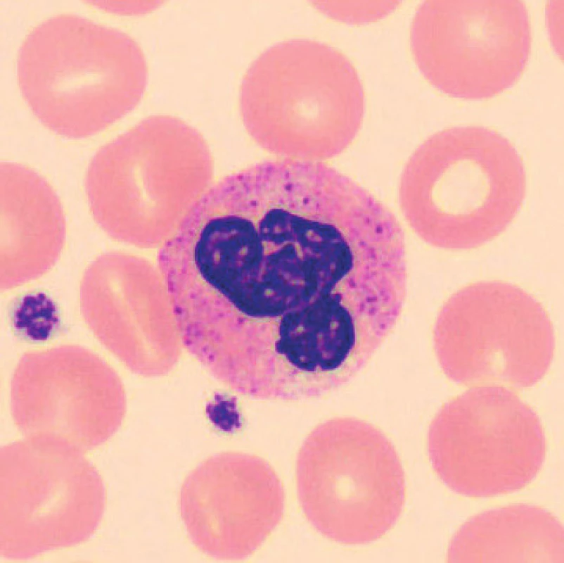 Neutrofilní segment (6 hodin po odběru, laboratorní teplota)
