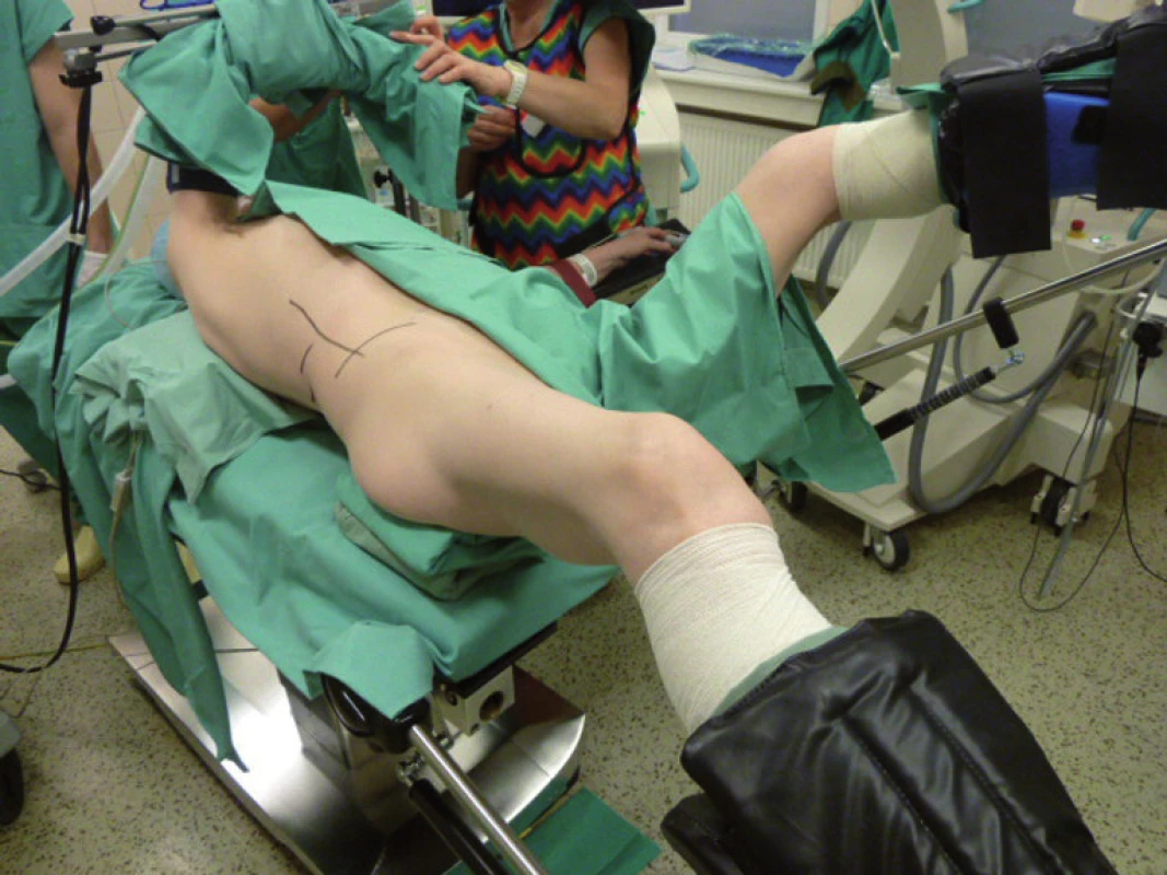 Nastavení polohy pacienta
Fig. 1. Setting patient’s position