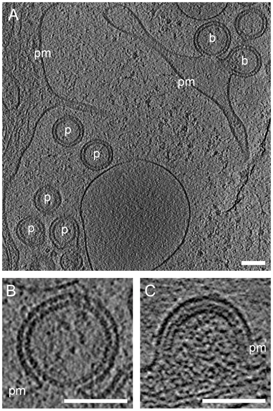 A previously undescribed Gag lattice in budding sites and released particles.