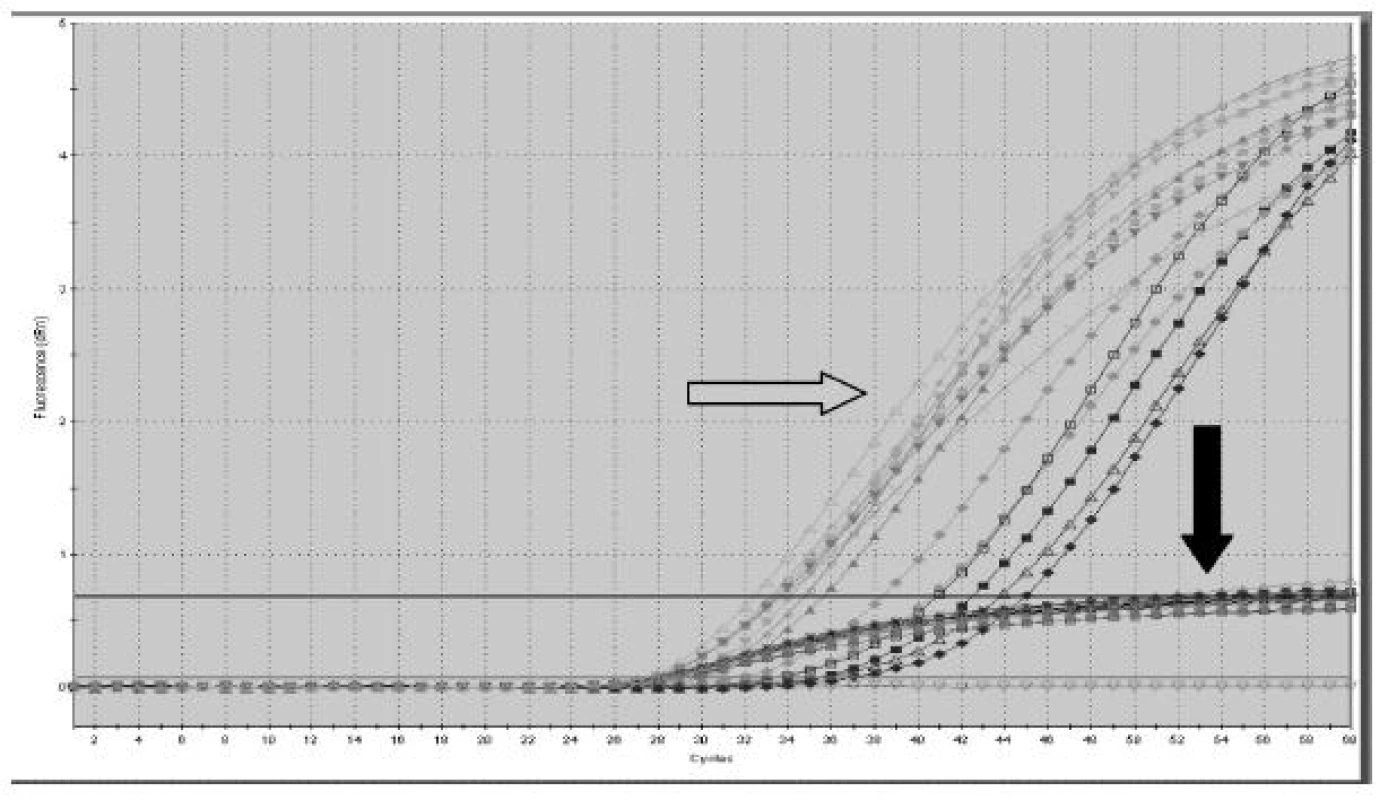 Ukázka výstupu Real Time PCR. Volná fetální DNA je posuzovaná v jednotlivých velikostních frakcích. Šedá šipka označuje záchyt fetální DNA (SRY), kdy plod je mužského pohlaví, a černá vnitřní kontrolu PCR