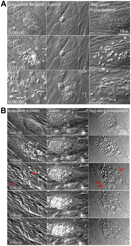 AKMT regulates parasite motility activation.