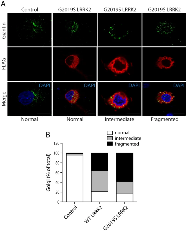 LRRK2 expression induces Golgi fragmentation in cortical neurons.