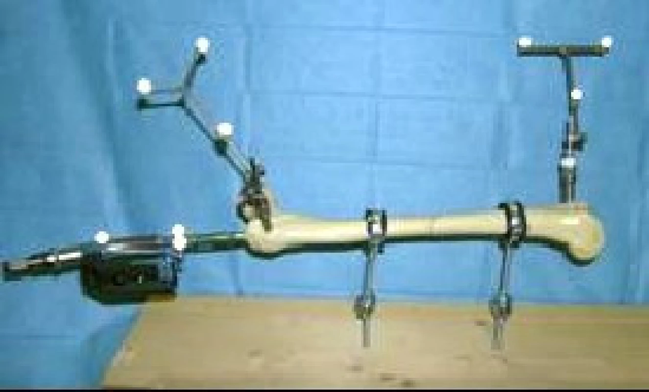 Model femuru