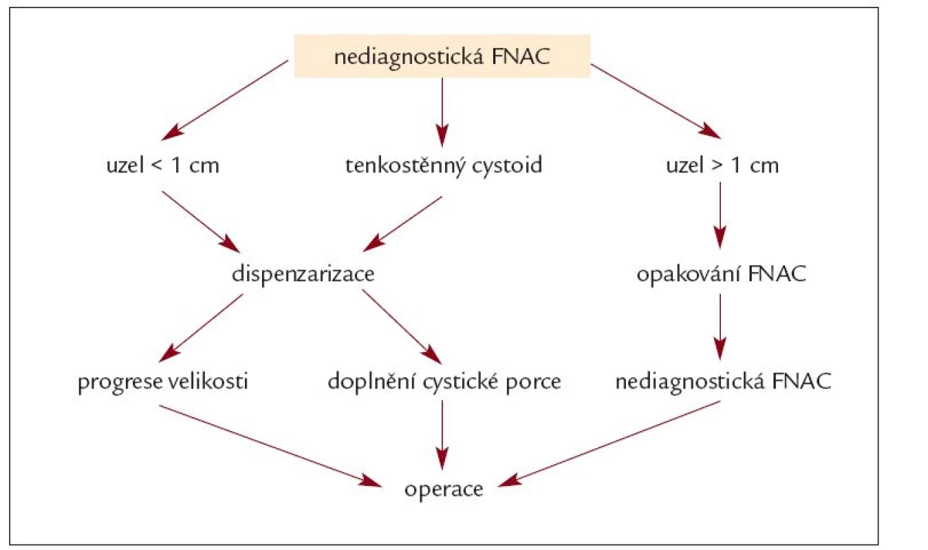 Algoritmus klinického postupu při suspektním výsledku FNAC.