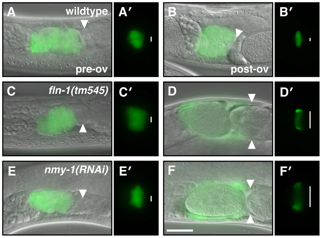 NMY-1 is required for spermathecal contractility.