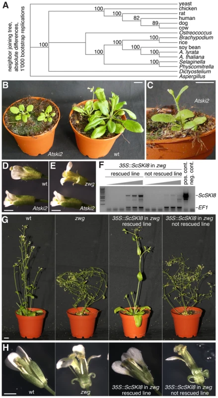 Phenotypes of the <i>Atski2</i> mutant and <i>vip3<sup>zwg</sup></i> rescued by transgenic ScSki8 expression.