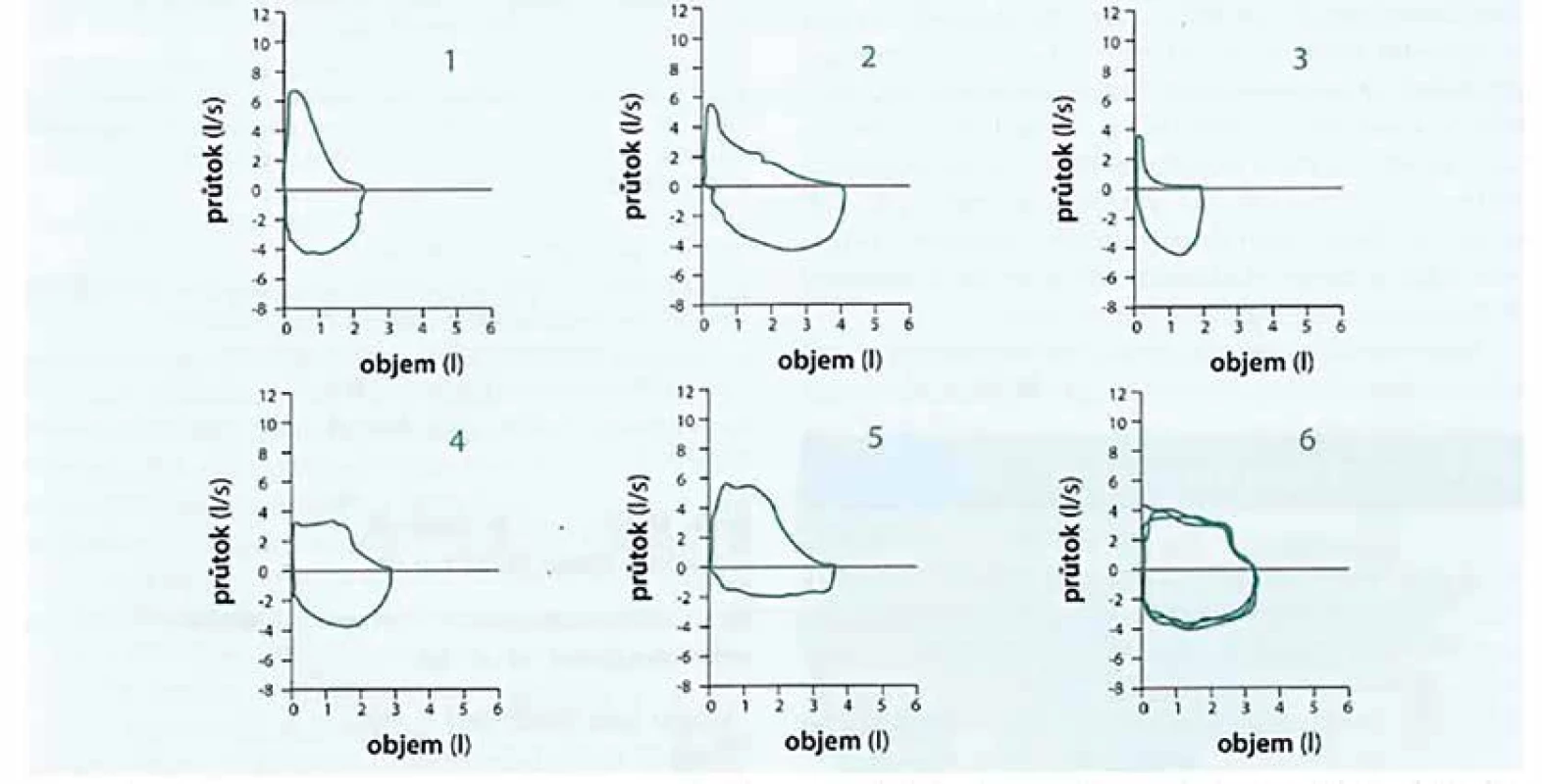 Spirometrie