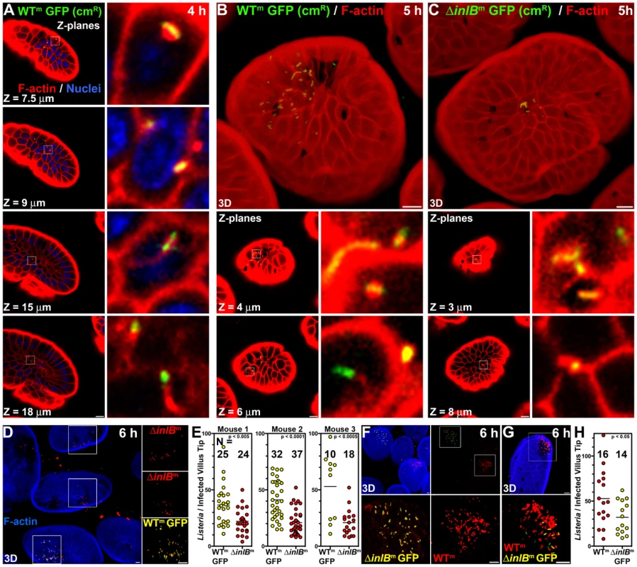 InlB-mediates invasion of intestinal villus tips.