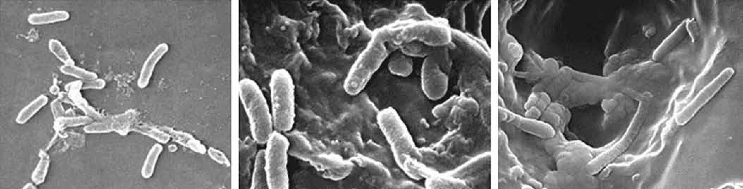 Tvorba biofilmu <i>Pseudomonas aeruginosa</i> [21].