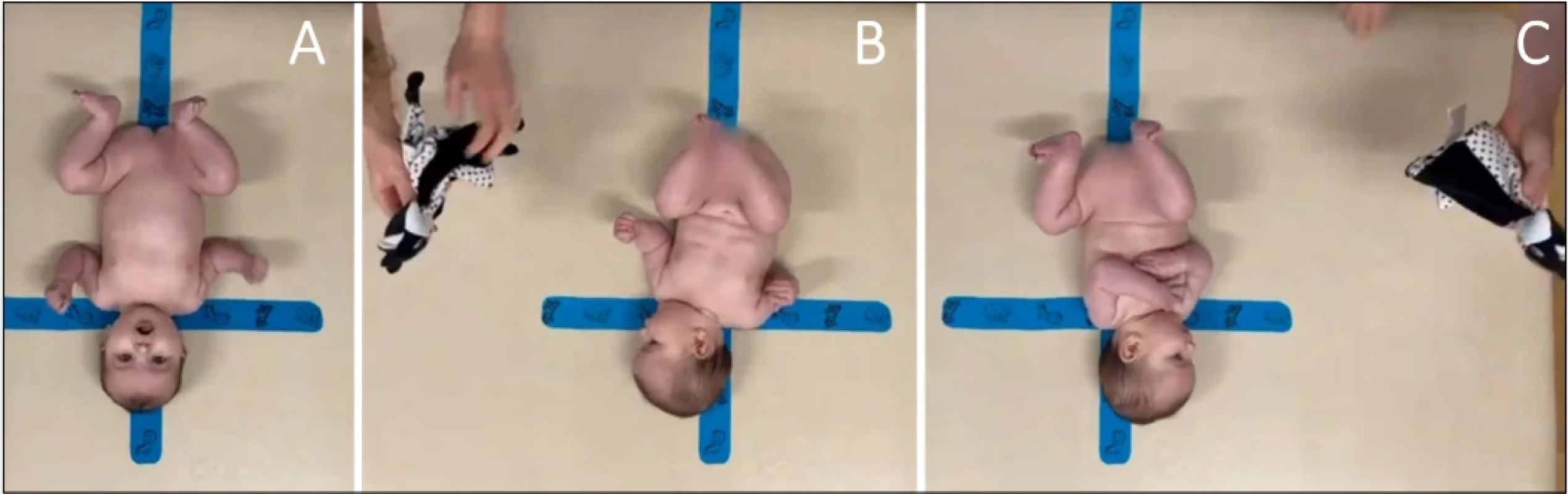 Poloha dítěte na zádech. A: Neutrální, startovací poloha. B: Stimulace z jedné strany. C: Stimulace z druhé strany. Fig. 1. Child in a supine position. A: Neutral starting position. B: Stimulation from one side. C: Stimulation from the other side.