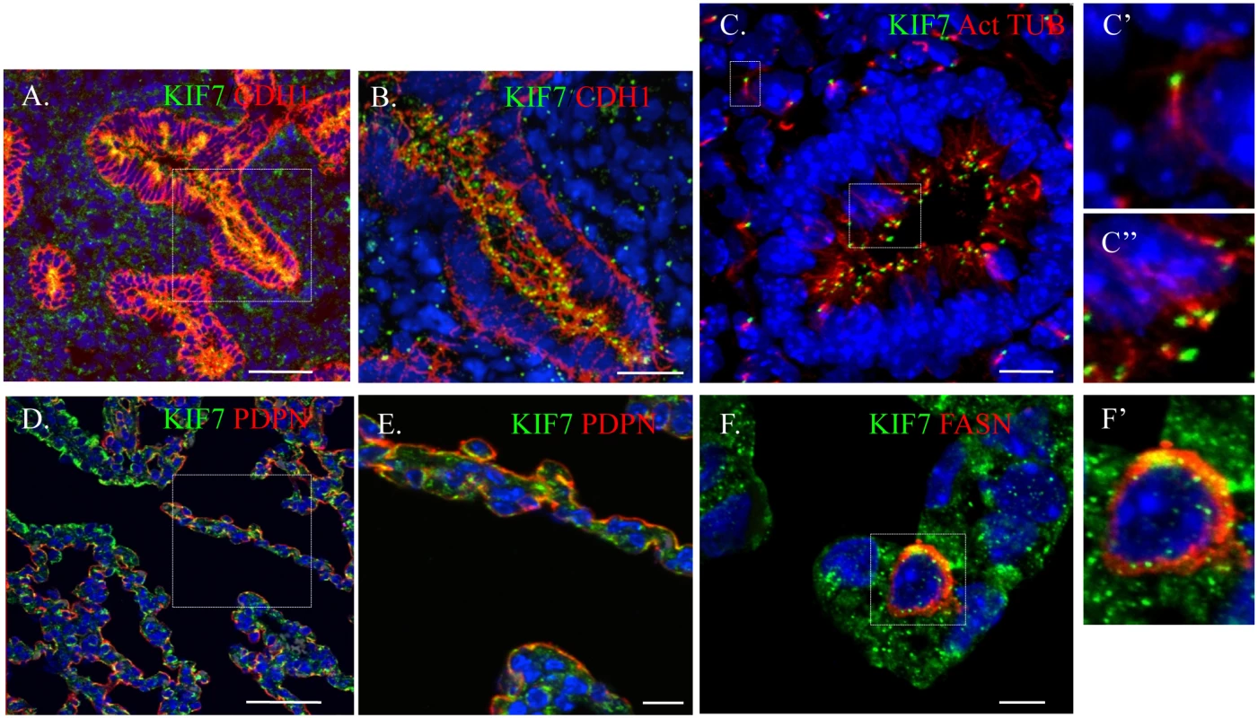 KIF7 is Expressed in the fetal and postnatal lung.