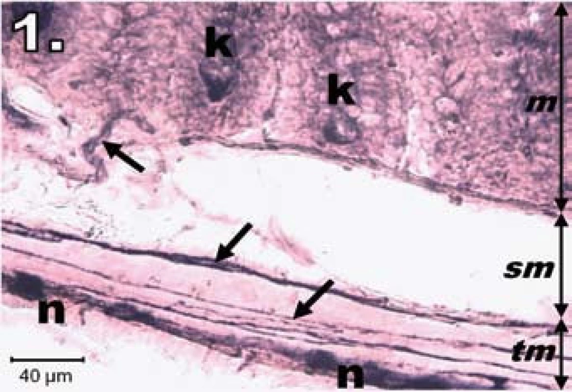 Histologický obraz jejuna v kontrolnej skupine. n – NADPH-d pozitívne neuróny silne pozitívne, šípky – nervové vlákna silne pozitívne, k – Lieberkühnove krypty s NADPH-d aktivitou na ich dne, m – mukóza, sm – submukóza, tm – tunica muscularis; scale bar = 40 μm
Fig. 1. Histological picture of jejunum in the control group. n – neurons fully NADPH-d positive, arrows – positive nerve fibres, k – positivity in Lieberkühn's crypts, m – mucosa, sm – submucosal layer, tm – tunica muscularis; scale bar = 40 μm