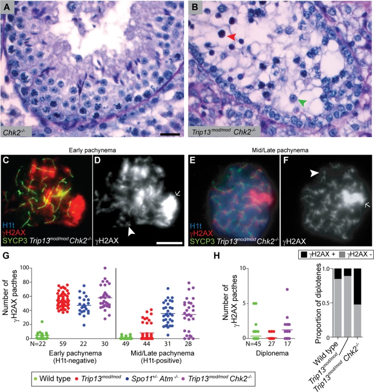 CHK2 is required to maintain early pachytene arrest caused by TRIP13 deficiency.