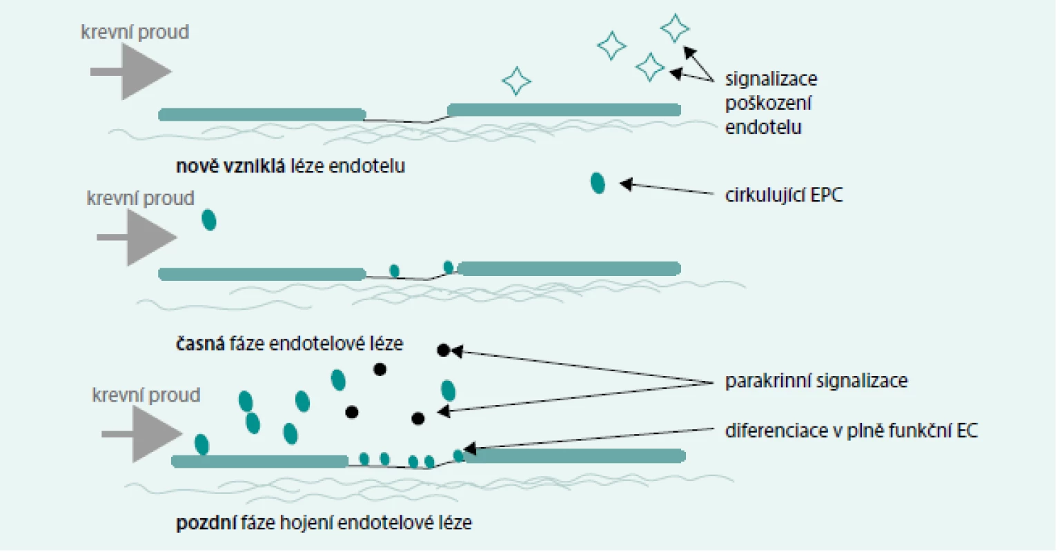 Předpokládaný význam endoteliálních progenitorových buněk v reparaci endotelové léze