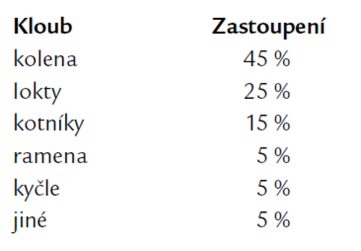 Podíl jednotlivých kloubů na kloubním krvácení u těžké hemofilie [4].