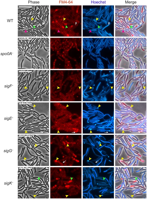 <i>C. difficile sigF</i> <sup>−</sup> sigE<sup>−</sup>, <i>sigG<sup>−</sup></i>, and <i>sigK<sup>−</sup></i> sigma factor mutants are defective in mature spore formation.
