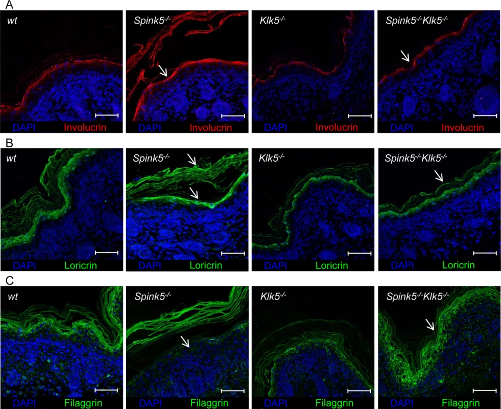 <i>Spink5</i><sup><i>-/-</i></sup><i>Klk5</i><sup><i>-/-</i></sup> skin does not show evidence of abnormal epidermal differentiation.