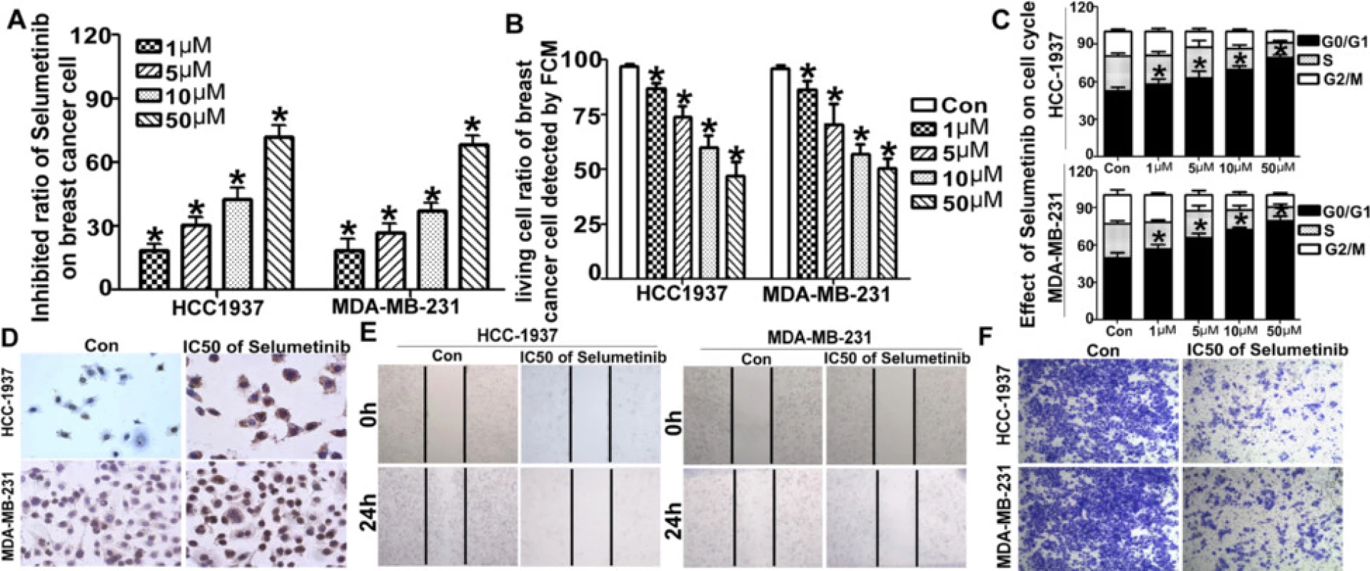 Selumetinib regulates apoptosis and the cell cycle in breast cancer cells. a Selumetinib inhibited the viability of TNBC. After exposure to various concentration (from 1 to 50 μM) of Selumetinib for 24 h, the proliferation inhibited ratios of HCC-1937 and MDA-MB-231 were determined using the MTT assay. The formula is Inhibition ratio = (1- Experimental OD / Control OD)*100 %. For the untreated control group, the inhibition ratio is 0 (For HCC1973 cells, the inhibition ratios are 18.53 ± 5.75, 30.57 ± 6.89, 42.83 ± .89, 42.8ition ratios are 18.53n For MDA-MB-231 cells, the inhibition ratios are 17.83 ± 8.43, 27.27 ± 7.41, 37.57 ± 5.65 and 68.53 ± 7.71 respectively. *P < 0.001 compared with the untreated control group.). b HCC-1937 and MDAMB-231 cells were treated with 1–50 μM Selumetinib for 24 h. It showed statistical analysis of the living cell ratio using Annexin V and PI stain by FASC method. The living cell is the double negative cells in the third quadrant (For HCC1973 cells, the living cells ratios are 86.67 ± 4.51, 73.67 ± 9.07, 59.93 ± 9.46 and 47.03 ± 10.57 respectively. For MDA-MB-231 cells, the living cells ratios are 86.23 ± 7.29, 70.53 ± 15.74, 56.73 ± 7.94 and 50.13 ± 8.48 respectively. *P < 0.01 compared with the untreated control group) c HCC-1937 and MDA-MB-231 cells were treated as b. The cells were stained with PI only, and the cell cycle distribution was determined using FACS too. The statistical analysis show the cells were arrest in G1 stage (For HCC1973 cells, the G1 ratios are 57.03 ± 5.93, 62.39 ± 7.44, 67.21 ± 1.92 and 77.69 ± 2.21 respectively vs 48.277vely. For MDA-MB-231 cells, the G1 ratios are 55.29 ± 3.66, 65.27 ± 2.84, 70.33 ± 1.06 and 75.84 ± 2.92 respectively vs 47.16 ± 4.07. *P < 0.01 compared with the untreated control group). d Tunnel method was used to detect the apoptosis too. In Selumetinib group, there were brown particles in positive cell. e Wound-healing assay showed untreated cell rapidly closed the scratch wounds compared with the IC50 dose of Selumetinib. f Transwell migration assays indicated that the Selumetinib resulted in significant reduction of cell migration