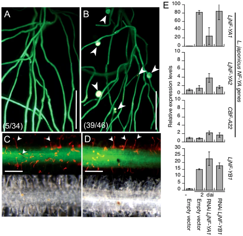 Inhibition of root nodule development by the knockdown of <i>LjNF-YA1</i>.