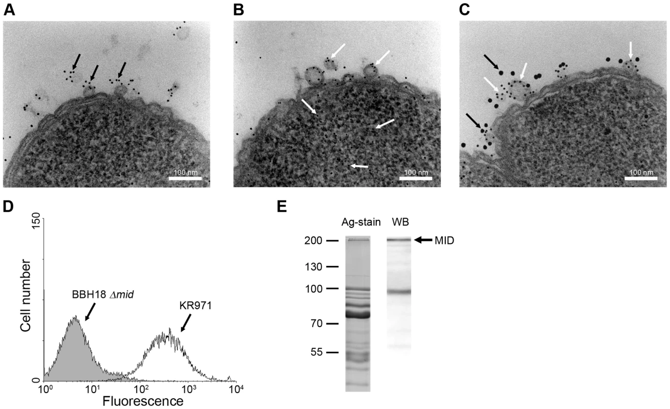 <i>M</i>. <i>catarrhalis</i> OMV secreted <i>in vivo</i> contain MID and DNA.