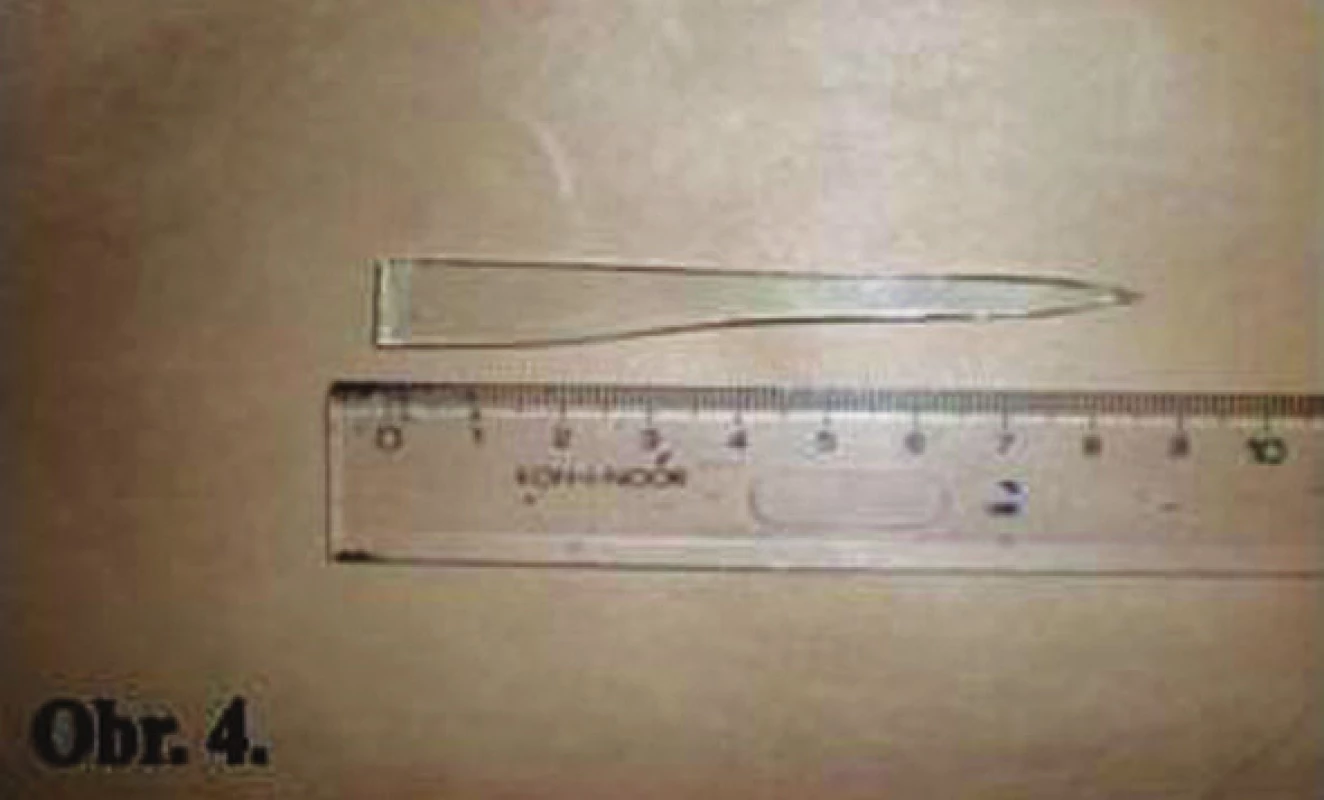 Úlomok skla
Fig. 4: The fragment of glass