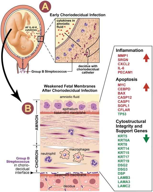 Our conceptual model of the events is shown to connect choriodecidual infection with weakening of the chorioamnion intracellular matrix.