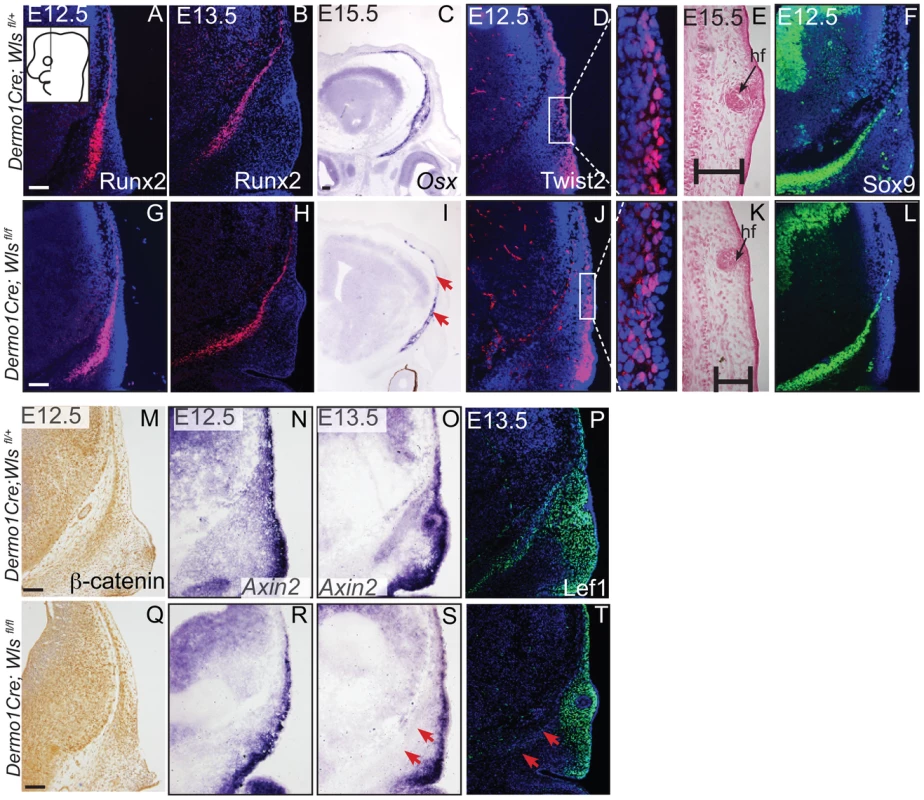 Mesenchyme deletion of <i>Wntless</i> leads to diminished differentiation and Wnt responsiveness in the bone lineage.