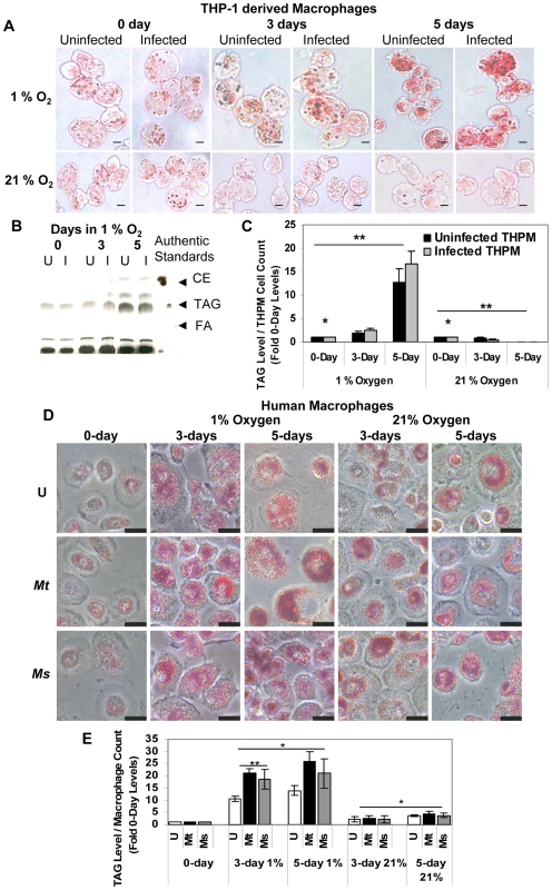 Macrophages under hypoxia accumulate Oil Red O staining lipid droplets containing triacylglycerol.