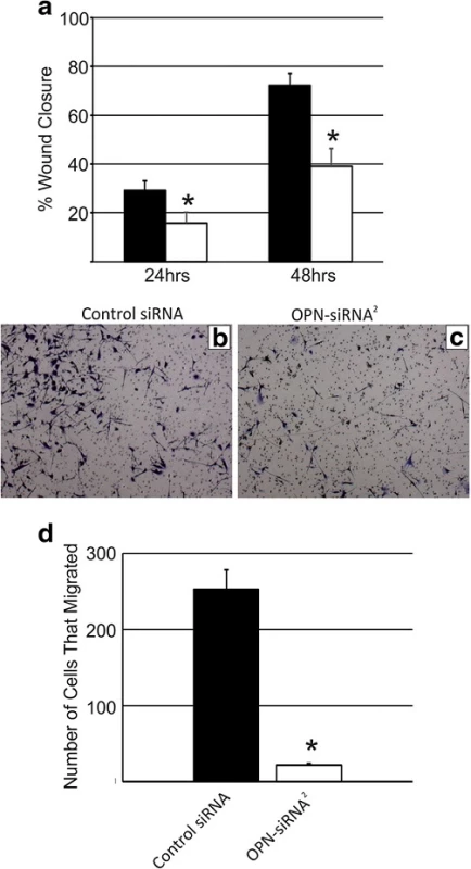 Quantification of (a) RJ348 cell migration following treatment with a GC control siRNA or OPN-siRNA<sup>2</sup> as determined by a scratch wound assay 24 or 48 h after scratch induction. Representative images of RJ348 cells that migrated to the opposite side of a transwell assay following treatment with (b) GC control siRNA or (c) OPN-siRNA<sup>2</sup>. The bars represent mean ± SEM. A paired T-test was used to determine statistical significance, *<i>p</i>˂0.05, n = 3. (d) Quantification of the number of cells that migrated in the transwell assay after treatment with a GC control siRNA or OPN-siRNA<sup>2</sup>. The bars represent mean ± SEM. A paired t-test was used to determine statistical significance, *<i>p</i>˂0.05, n ≥ 3