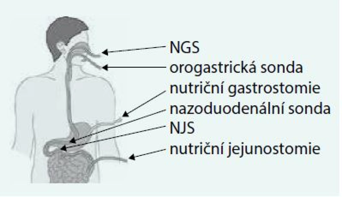Použitelné vstupy pro domácí enterální výživu.
Upraveno podle http://www.baxternutritionacademy.com