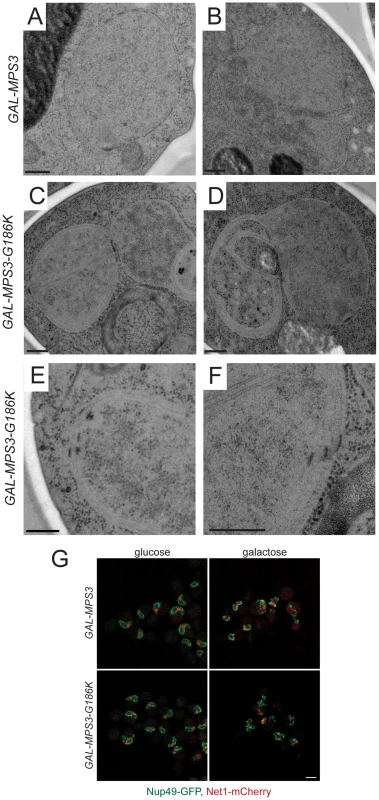 Over-proliferation of the nuclear membrane in <i>GAL-MPS3-G186K</i>.