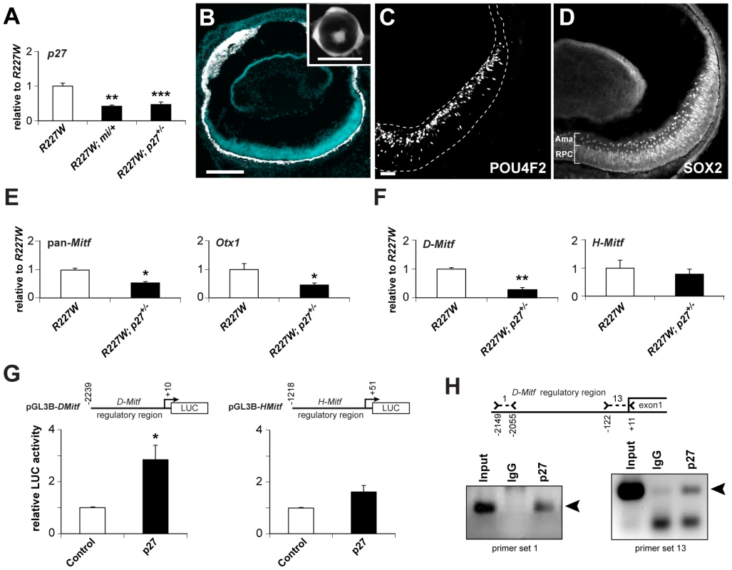 p27Kip1 is part of a gene regulatory network promoting pigmentation in the <i>R227W</i> retina.