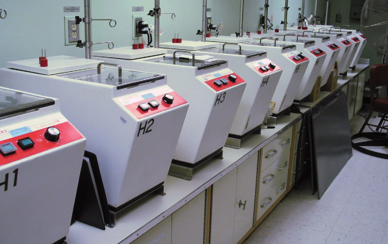 Baterie promývacích automatů na deglycelorizaci Haemonetics ACP-115 – první plně automatické zařízení tohoto typu.