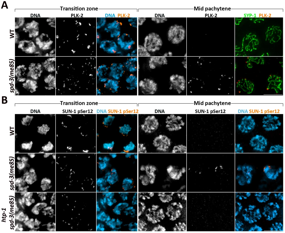 Markers of the transition zone persist in <i>spd-3(me85)</i> mutants.