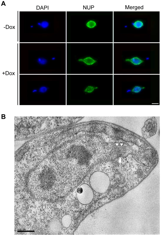 TbKif13-1 depletion results in protrusions of the nuclear envelope.