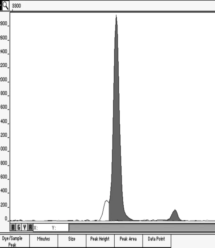 Elektroforetogram artificiální genotypické směsi v poměru 1:49
Ukázka elektroforetogramu genotypů XX/XY v poměru 49/1.