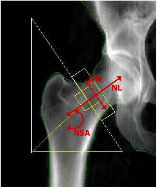Hip geometry indices.