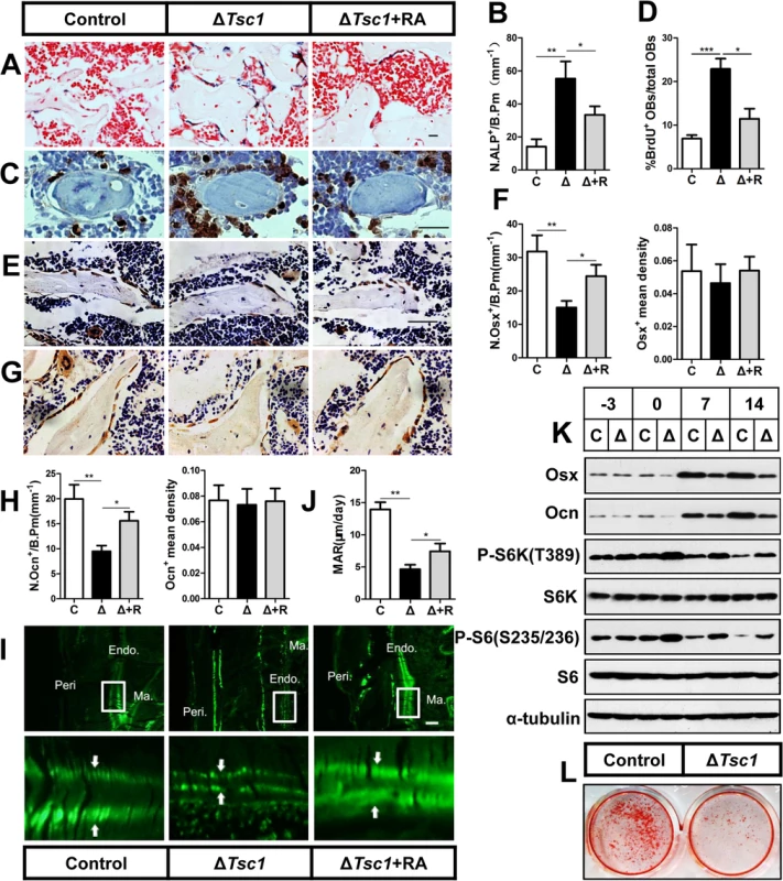 mTORC1 promotes proliferation of preosteoblasts but prevents their maturation.