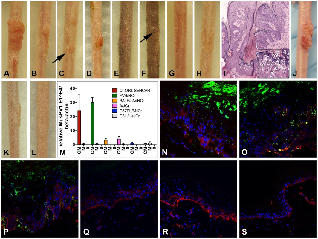 Cyclosporin (CsA) administration promotes MusPV1 infection and strain-dependent papilloma formation.