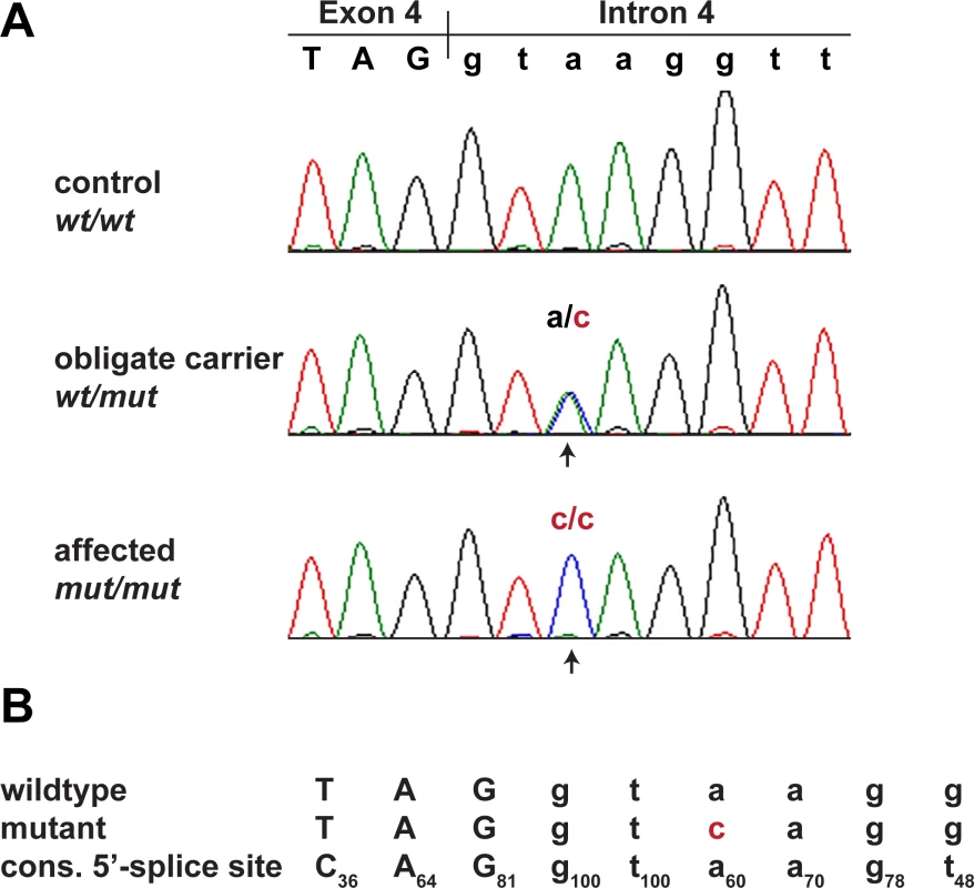 Sanger confirmation of the <i>MKLN1</i>:c.400+3A>C variant.