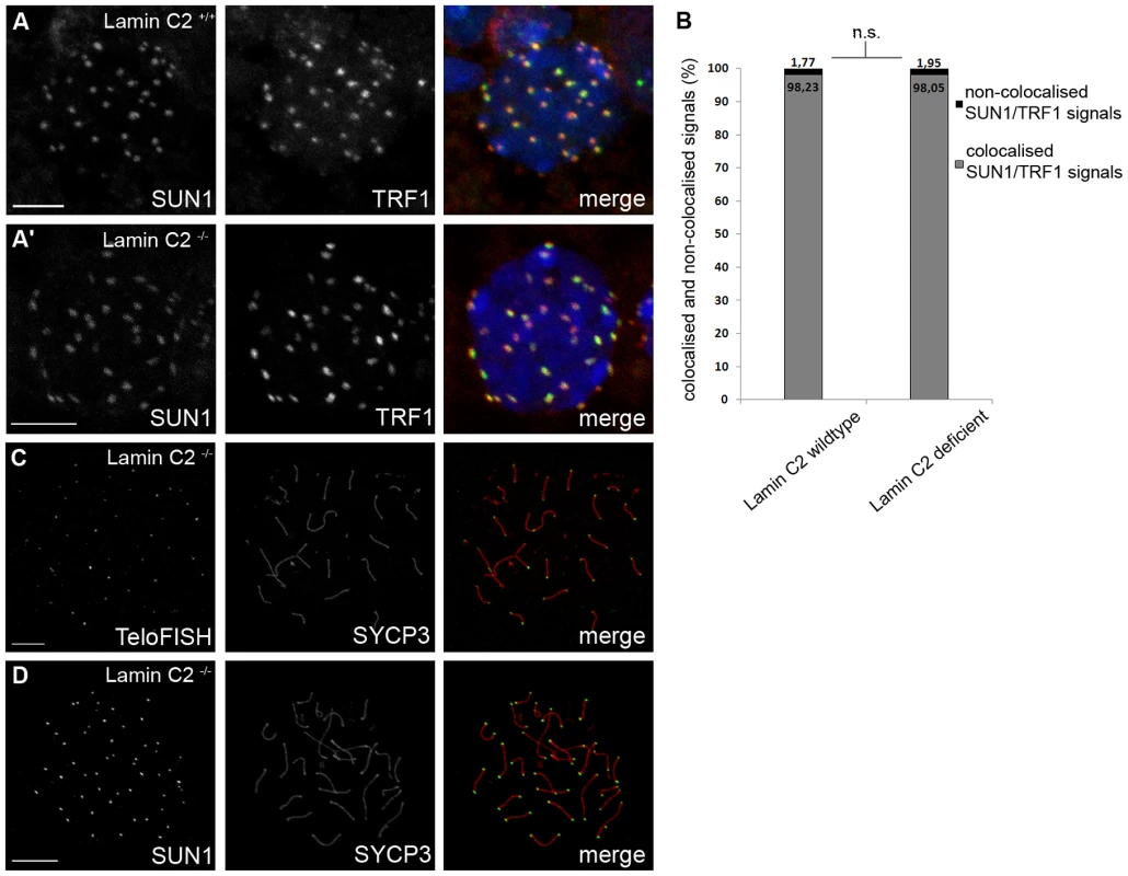 Loss of lamin C2 has no effect on meiotic telomere attachment.
