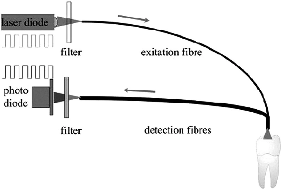 Schéma přístroje DIAGNOdent (fa KaVo) [4]